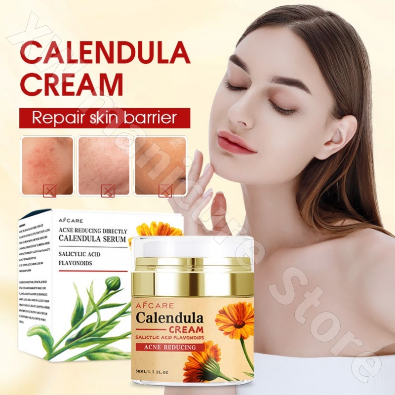 Luxury Skincare Whitening Cream - 캘렌듈라 크림 수리 보습 및 피부