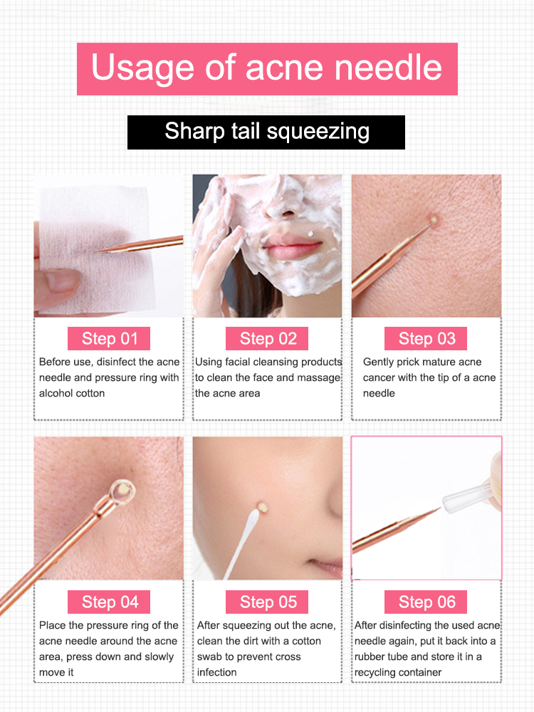 블랙 헤드 리무버 여드름 코돈 추출기 도구 흠집을위한  - Luxury Skincare Acne 리뷰 및 가격