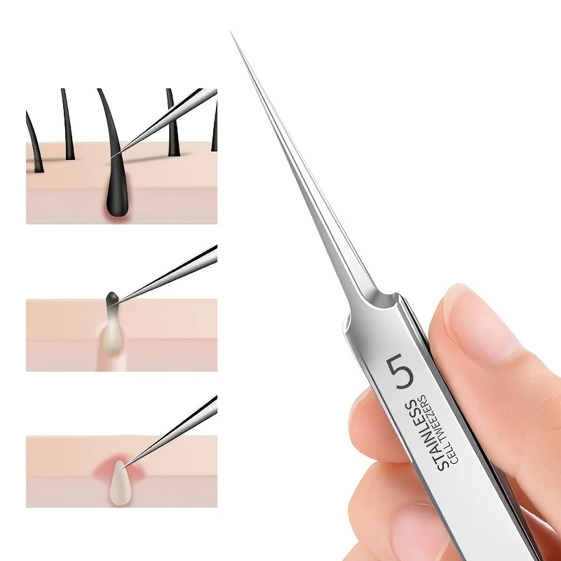 고품질 여드름 블랙헤드 제거 키트 코 얼굴 모공 클렌징 - Luxury Skincare Acne 리뷰 및 가격
