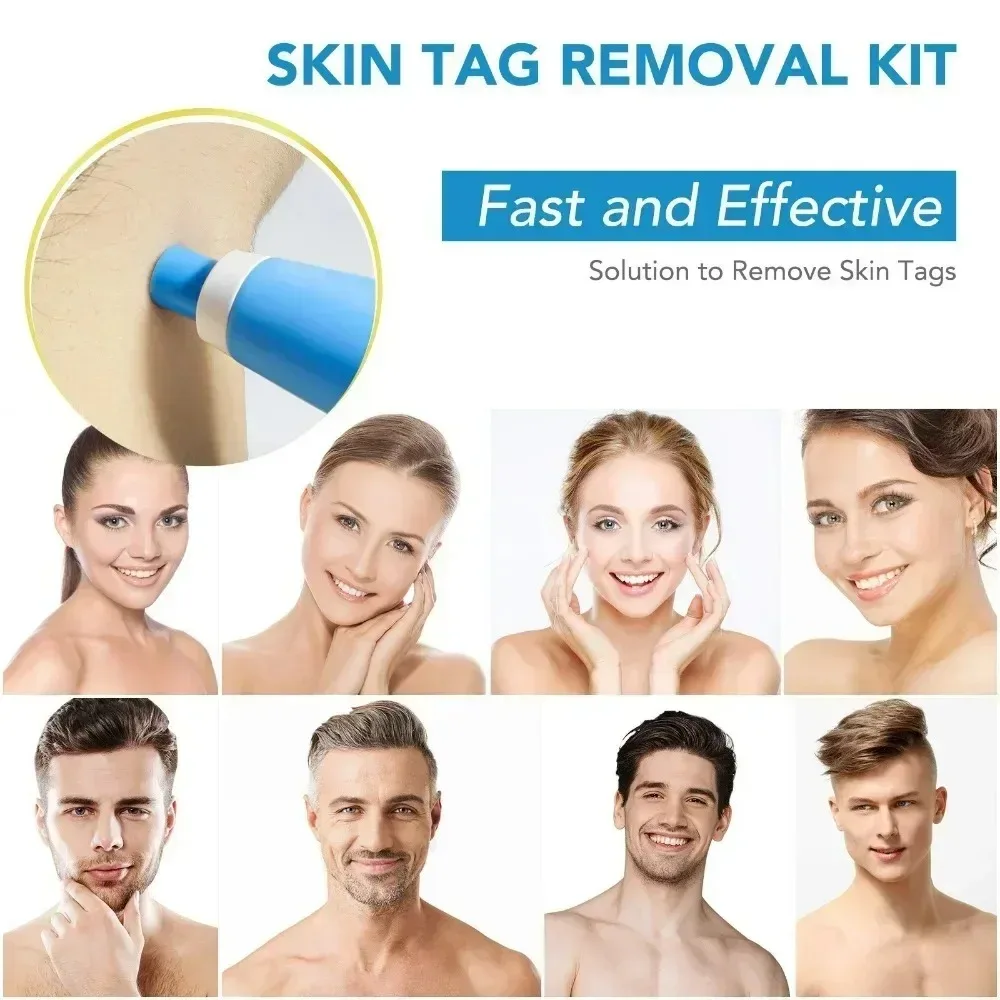 여드름 제거제 2 IN 1 자동 마이크로 스킨 태그 리 - Luxury Skincare Acne 리뷰 및 가격