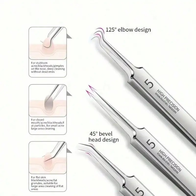 1/4/8개 스테인리스 스틸 블랙헤드 제거 도구 세트  - Luxury Skincare Acne 리뷰 및 가격